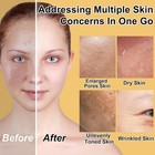 Skin Care Set For Women Teen 6 Pcs - Hydrating   Anti-aging Facial Routine Skinc