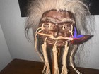 Gray Woolly Jivaro Shrunken  Head With Chonta Arrow-tsantsa