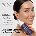 Dark Spot Remover For Face And Body     Dark Spot Corrector Serum     Hyperpigmentat