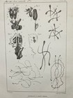 1850 Male Reproductive System Litho Print Anatomy Sperm Antique Medical Art Odd