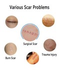 2 Tubes  30 Grams  Of   ermatix Ultra Advanced Scar Formula Advanced Silicone Gel