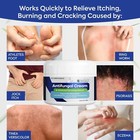 Antifungal Cream For Jock Itch  2  Miconazole Anti Fungal Cream For Itchy Skin R