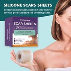 Silicone Scar Sheets  1 6  X 60  Roll-1 5m  Silicone Scar Tape For Surgical Scar