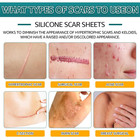 Silicone Scar Sheets  Silicone Scar Tape For Surgical  Hypertrophic  Keloid  C-s