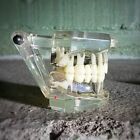 Disease Teeth Model  Clear Dental Teeth Model  Vintage Medical  Oddities  Weird
