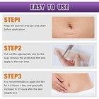 Silicone Scar Sheets  Medical Grade Silicone Scar Tape For Old   New Scars