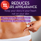 Advanced Scar Gel 1 Oz Treatment For Surgical Stretch Mark Acne Burns Us