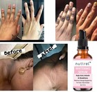 100  Pure Kojic Acid Skin Lightening Serum 30ml   new Pack  