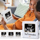 Triple Ultrasound Picture Frames  Baby Sonogram Photo Frame Pregnancy Ultraso   