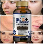 Glutathione White Pills - Dark Spots   Acne Scar Support Skin  Usa 100 