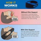 2 Pack Anti Snore Chin Strap Stop Snoring Belt Sleep Apnea Support Solution