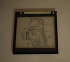 Vintage Magic Lantern Slide Throat Operation Diagram C1947 Medical Drawing