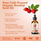 Natural Cold-pressed Rosehip Seed Oil 100  Pure Raw Skin Hair Face Anti-aging