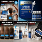 Kirkland Minoxidil 5  Hair Regrowth Treatment Extra Strength For Men 6 Months
