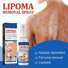 50ml Lipomheilung Reduction Spray  Instant Lumpfree Lipoma Removal Spray