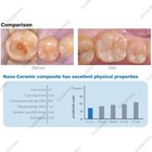 Dental Compules Unidose Composite Resin Capsules Light Cure Fit Tph Kerr A1 2 3