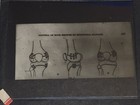 Set Of 12 Vintage Kodak Glass Slides Negatives Medical Student Education Polio