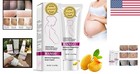 Natural Hydrating Stretch Marks   Scar Cream For Moms - 40g Of Luxury Care