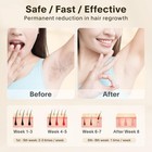 Permanent Hair Removal  Mismon Ipl Laser Hair Removal For Women men  At-home 