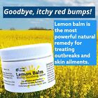 Urban Releaf Lemon Balm Blister Soothing Salve  Cold Sore Shingles Chicken Pox