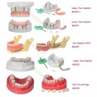 Dental Implant Training Model Upper   Lower Jaw With Overdenture Demo   Base
