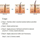 0 5mm Beard Hair Regrowth 540 Derma Micro Needle Titanium Roller Anti Hair Loss