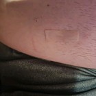 Scar Away Silicone Scar Sheets - Size 1 6  X 60  Exp 01 27 28 - Brand New Sealed