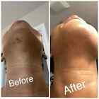    Dark Skin   Spot Bleaching Cream Whitening Lightening Retinol Care Face   Body