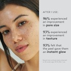 Skin Care Triple Acid Peel  2-step Exfoliating Peel With Mandelic  Lactic   G   