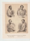 3 Antique C  1880 Civil War Medical Surgical Prints Id d Soldiers W  Bell Photos