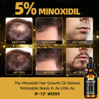 5  Minoxidil Hair Growth Oil 2 11 Oz Men Women Hair Loss Beard Treatment