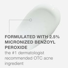 Neutrogena Stubborn Acne Am Face Treatment With 2 5  Micronized Benzoyl    