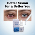Best Cataract Eye Drops Glaucoma  Non Carnosine  nac   Can Cataracts C Bright