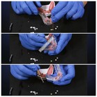 Dental Novalo Mounting And Demounting Tool Retention Inserts Locator Core Tool