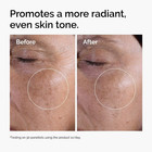 The Ordinary Glycolic Acid 7  Exfoliating Brightening Daily Toner 3 38 Oz