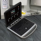 Chison Sonobook 9 Ultrasound   2d Convex   Endocavity   3d 4d Volume Transducers