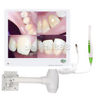 17 Inch Dental Intra Oral Camera Wifi High Definition Digital Lcd Aio Monitor