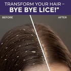 Sanfe Anti Lice   Dandruff Shampoo   Lice Shampoo   Kills Super Lice 100ml