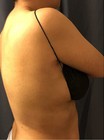 Case Of 500 Disposable Spa Tanning Bras Black Non-woven Individually Wrapped