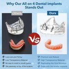 Us Dental Overdenture Implant All On 4 Implant Model With 4 Screws Denture Model