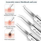 Acne Needle Blackhead Remover - Pimple   Comedone Extractor Tool Kit With Tweeze