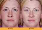 Kojic Acid Skin Whitening Lightening Ultra Brightening Serum Dark Spot Cream  Us