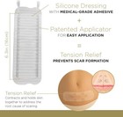 Embrace Active Scar Defense For New Scars  Fda-cleared Medical-grade Silicone