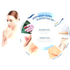 Scar Gel Dermatix Ultra Advanced 15g Silicone Treatment Lot Of 10 Tubes - 2026