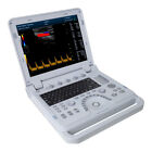 Portable Ultrasound Scanner Laptop Machine Color Doppler Convex Linear Cardiac