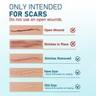 Silicone Scar Sheets 10pcs  Reusable Scar Strips  1 5  X 6   Surgical Scars