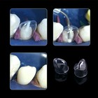Dental Preformed Crown Resin Temporary Pre-corona Transparent Anterior Molar