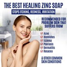 Herblov Pyrithione Zinc Soap Bar For Face   Body  4oz   4 Ounce  pack Of 1 