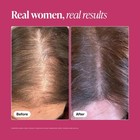 New Box 3 Pack Viviscal Hair Growth Supplements Women Thicker Fuller Hair 180 Tb