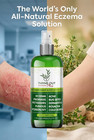 Plus Natural Skin Relief Spray For Eczema  Acne  Bug Bites   Irritated Skin     Sa